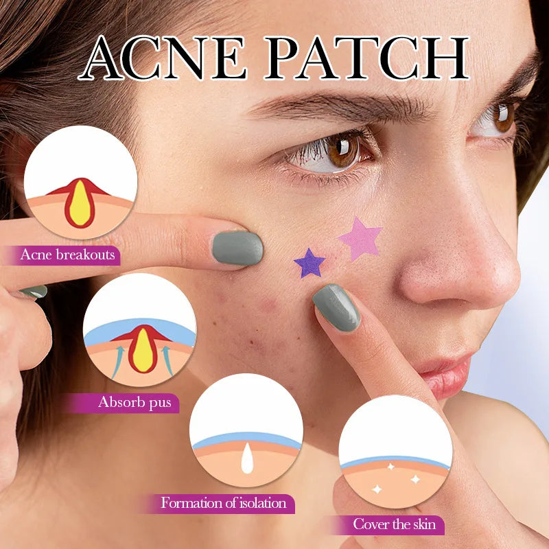 7/10/14Pcs Colorful Star Acne Patch Improve Women Skin Hydrocolloid Acne Tool Invisible Acne Cover Pimple Patch Skin Care Tools