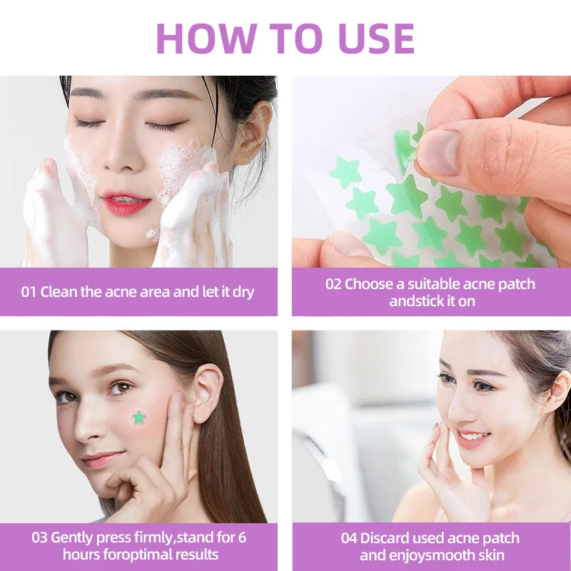 7/10/14Pcs Colorful Star Acne Patch Improve Women Skin Hydrocolloid Acne Tool Invisible Acne Cover Pimple Patch Skin Care Tools